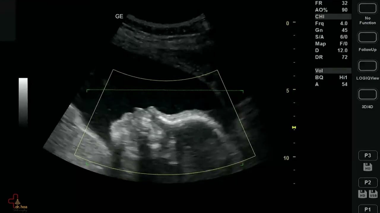 Thai 28 tuan be rat de thuong sieu am thai