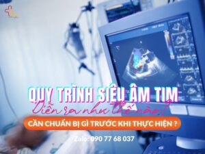Quy trình siêu âm tim diễn ra như thế nào?
